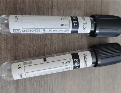 Helblods ESR-rör